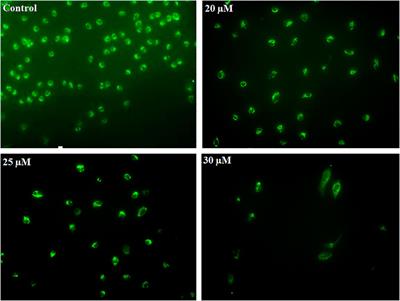 Phenethyl Isothiocyanate Induces Apoptosis Through ROS Generation and Caspase-3 Activation in Cervical Cancer Cells